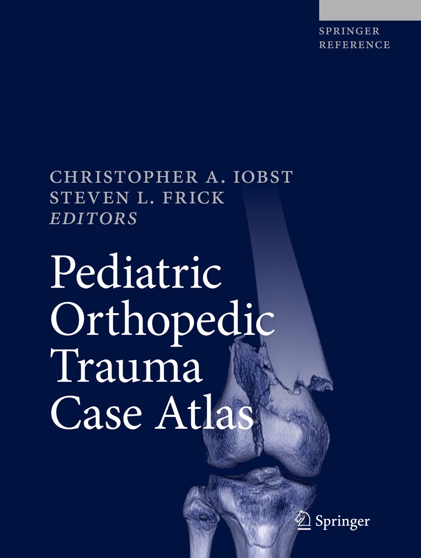 Titlebook: Pediatric Orthopedic Trauma Case Atlas; Christopher A. Iobst,Steven L. Frick Reference work 2020 Springer Nature Switzerland AG 2020 Axial Titlebook: Pediatric Orthopedic Trauma Case Atlas; Christopher A. Iobst,Steven L. Frick Reference work 2020 Springer Nature Switzerland AG 2020 Axial