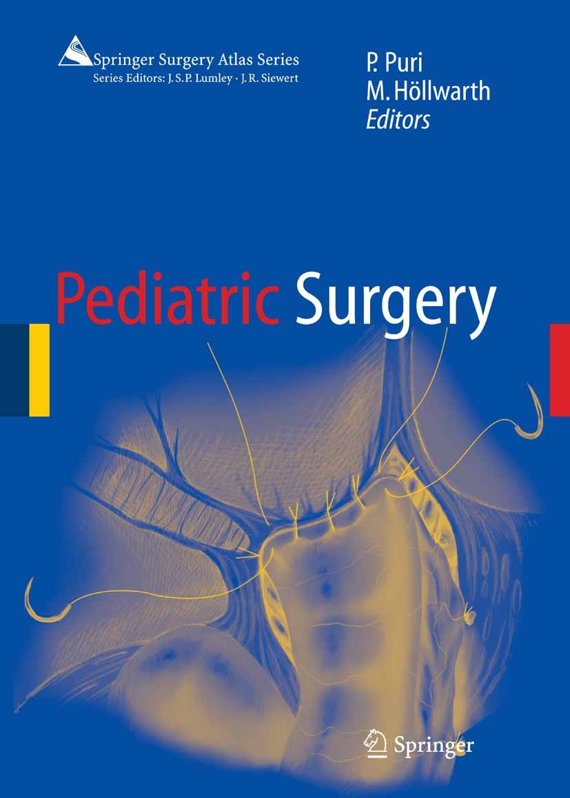 Titlebook: Pediatric Surgery; Prem Puri (Newman Clinical Research Professor),Mic Book 20061st edition Springer-Verlag Berlin Heidelberg 2006 Children Titlebook: Pediatric Surgery; Prem Puri (Newman Clinical Research Professor),Mic Book 20061st edition Springer-Verlag Berlin Heidelberg 2006 Children