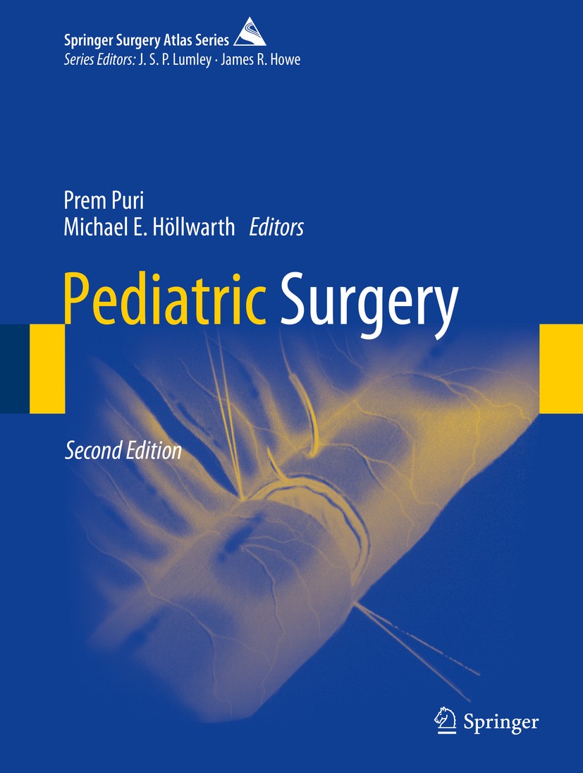 Titlebook: Pediatric Surgery; Prem Puri,Michael E. Höllwarth Book 2019Latest edition Springer-Verlag GmbH Germany, part of Springer Nature 2019 Pedia Titlebook: Pediatric Surgery; Prem Puri,Michael E. Höllwarth Book 2019Latest edition Springer-Verlag GmbH Germany, part of Springer Nature 2019 Pedia