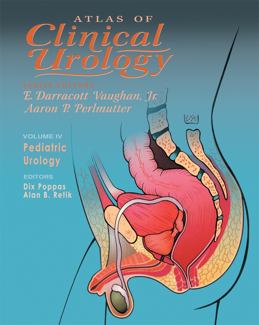 Titlebook: Pediatric Urology; Dix P. Poppas (The Richard Rodgers Family Assistan Book 2003 Springer Science+Business Media New York 2003 infection.ki Titlebook: Pediatric Urology; Dix P. Poppas (The Richard Rodgers Family Assistan Book 2003 Springer Science+Business Media New York 2003 infection.ki