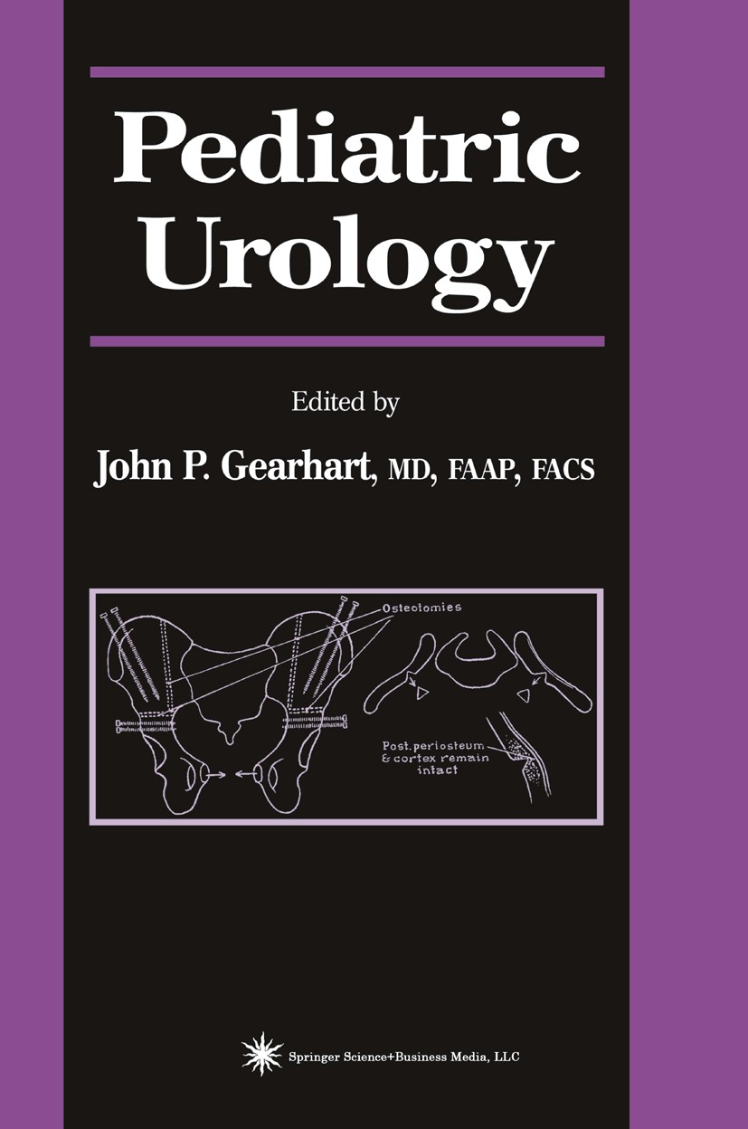 Titlebook: Pediatric Urology; John P. Gearhart Book 2003 Springer Science+Business Media New York 2003 oncology.testis.urology Titlebook: Pediatric Urology; John P. Gearhart Book 2003 Springer Science+Business Media New York 2003 oncology.testis.urology