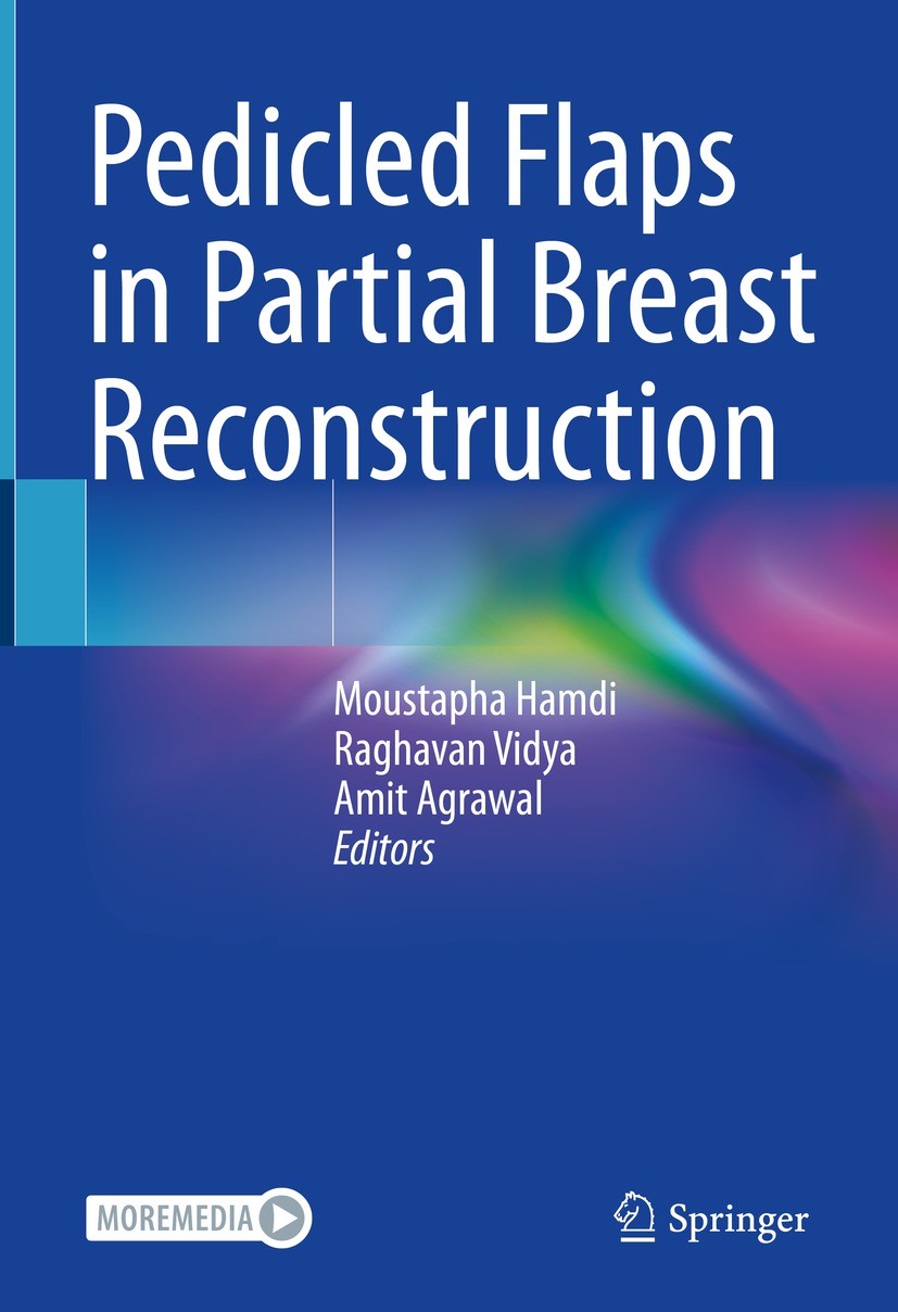 Titlebook: Pedicled Flaps in Partial Breast Reconstruction; Moustapha Hamdi,Raghavan Vidya,Amit Agrawal Book 2023 The Editor(s) (if applicable) and T Titlebook: Pedicled Flaps in Partial Breast Reconstruction; Moustapha Hamdi,Raghavan Vidya,Amit Agrawal Book 2023 The Editor(s) (if applicable) and T