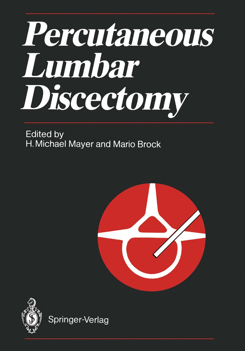 Titlebook: Percutaneous Lumbar Discectomy; H. Michael Mayer,Mario Brock Conference proceedings 1989 Springer-Verlag Berlin Heidelberg 1989 Bandscheib Titlebook: Percutaneous Lumbar Discectomy; H. Michael Mayer,Mario Brock Conference proceedings 1989 Springer-Verlag Berlin Heidelberg 1989 Bandscheib