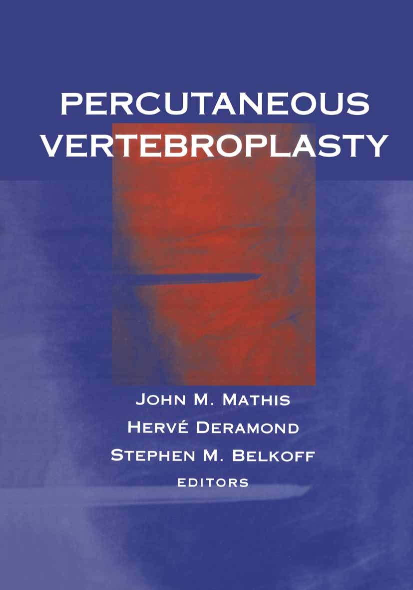 Titlebook: Percutaneous Vertebroplasty; John M. Mathis,Hervé Deramond,Stephen M. Belkoff Book 20021st edition Springer Science+Business Media New Yor Titlebook: Percutaneous Vertebroplasty; John M. Mathis,Hervé Deramond,Stephen M. Belkoff Book 20021st edition Springer Science+Business Media New Yor