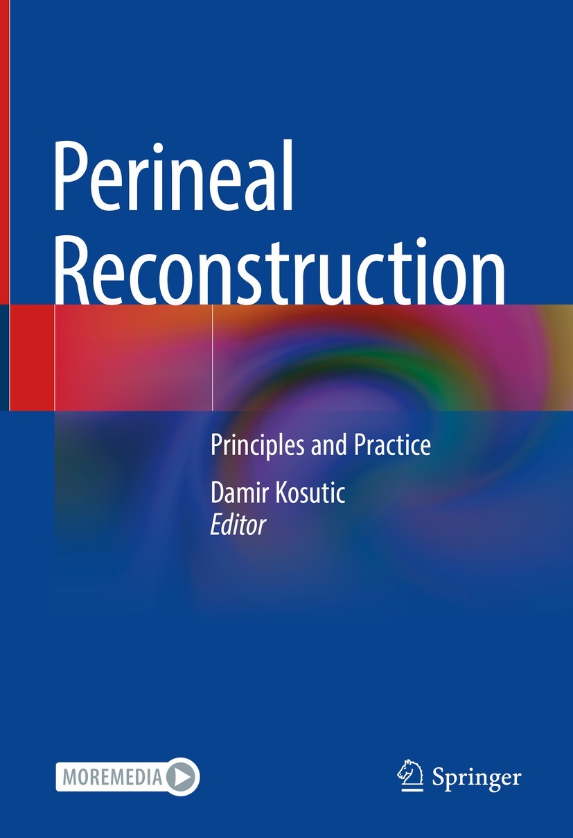 Titlebook: Perineal Reconstruction; Principles and Pract Damir Kosutic Book 2023 Springer Nature Switzerland AG 2023 perforator flaps.perineal defects Titlebook: Perineal Reconstruction; Principles and Pract Damir Kosutic Book 2023 Springer Nature Switzerland AG 2023 perforator flaps.perineal defects