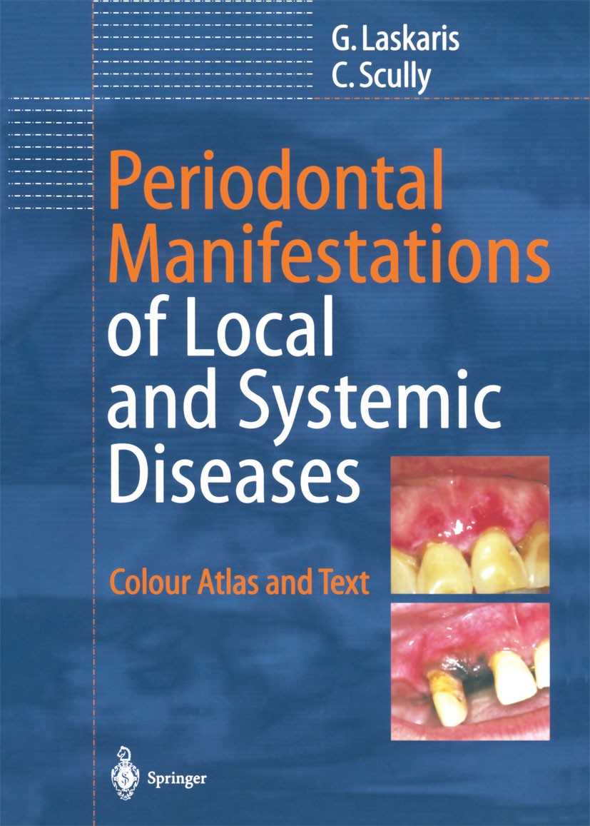 Titlebook: Periodontal Manifestations of Local and Systemic Diseases; Colour Atlas and Tex George Laskaris,Crispian Scully Book 20031st edition Spring Titlebook: Periodontal Manifestations of Local and Systemic Diseases; Colour Atlas and Tex George Laskaris,Crispian Scully Book 20031st edition Spring