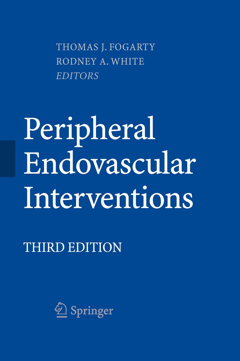 Titlebook: Peripheral Endovascular Interventions; Thomas J. Fogarty,Rodney A. White Book 2010Latest edition Springer-Verlag New York 2010 Aneurysms.A Titlebook: Peripheral Endovascular Interventions; Thomas J. Fogarty,Rodney A. White Book 2010Latest edition Springer-Verlag New York 2010 Aneurysms.A