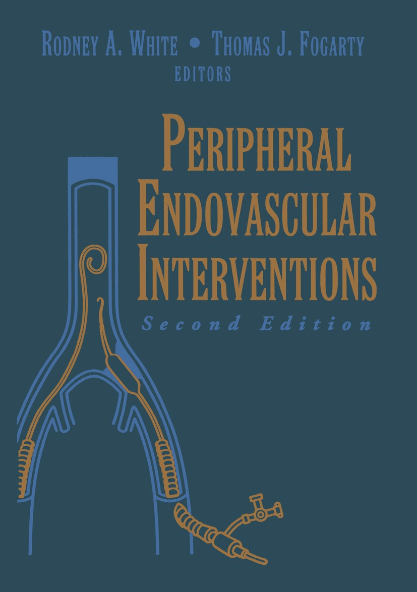 Titlebook: Peripheral Endovascular Interventions; Rodney A. White (Chief. Professor of Surgery),Thom Book 19992nd edition Springer Science+Business M Titlebook: Peripheral Endovascular Interventions; Rodney A. White (Chief. Professor of Surgery),Thom Book 19992nd edition Springer Science+Business M