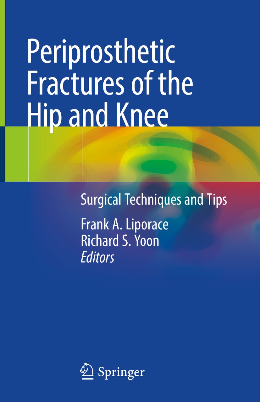 Titlebook: Periprosthetic Fractures of the Hip and Knee; Surgical Techniques Frank A. Liporace,Richard S. Yoon Book 2019 Springer Nature Switzerland Titlebook: Periprosthetic Fractures of the Hip and Knee; Surgical Techniques Frank A. Liporace,Richard S. Yoon Book 2019 Springer Nature Switzerland