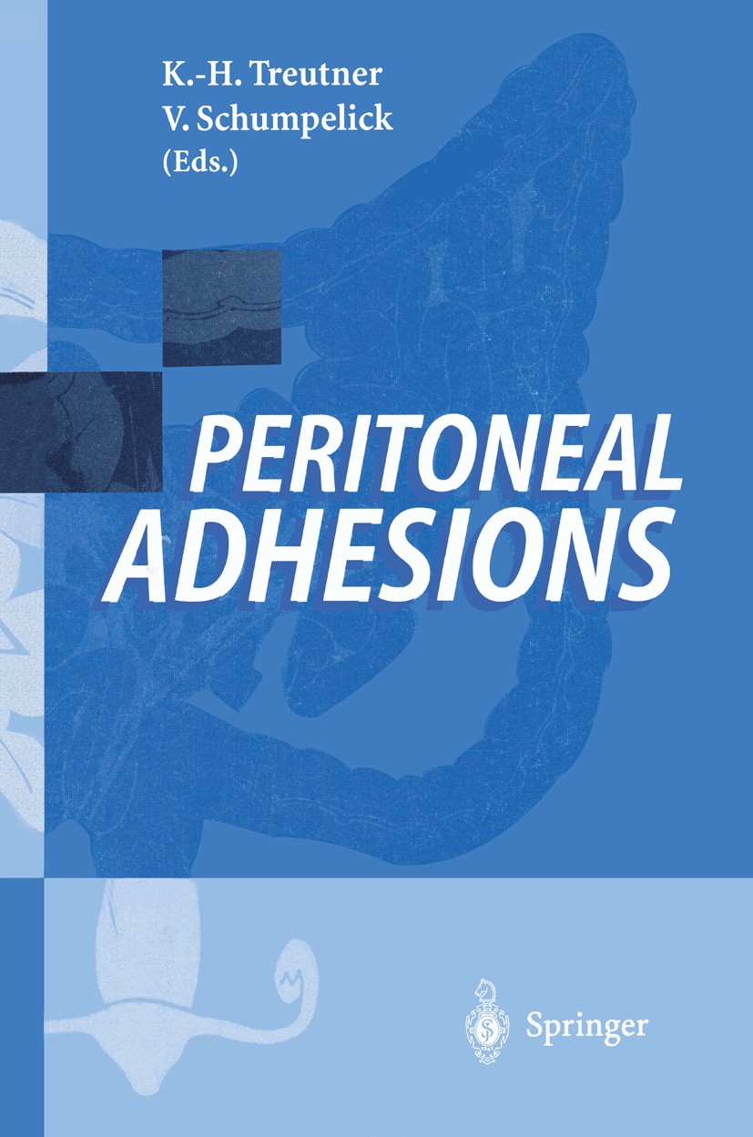 Titlebook: Peritoneal Adhesions; Karl-Heinz Treutner,Volker Schumpelick Conference proceedings 1997 Springer-Verlag Berlin Heidelberg 1997 Adhesions. Titlebook: Peritoneal Adhesions; Karl-Heinz Treutner,Volker Schumpelick Conference proceedings 1997 Springer-Verlag Berlin Heidelberg 1997 Adhesions.