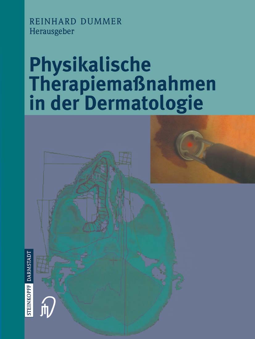 Titlebook: Physikalische Therapiemaßnahmen in der Dermatologie; Reinhard Dummer Book 20031st edition Springer-Verlag Berlin Heidelberg 2003 Dermatolo Titlebook: Physikalische Therapiemaßnahmen in der Dermatologie; Reinhard Dummer Book 20031st edition Springer-Verlag Berlin Heidelberg 2003 Dermatolo
