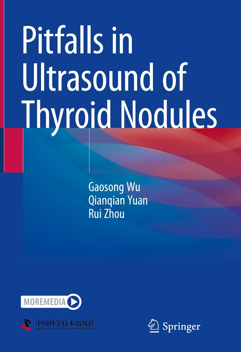 Titlebook: Pitfalls in Ultrasound of Thyroid Nodules; Gaosong Wu,Qianqian Yuan,Rui Zhou Book 2023 China Science and Technology Press 2023 Thyroid ult Titlebook: Pitfalls in Ultrasound of Thyroid Nodules; Gaosong Wu,Qianqian Yuan,Rui Zhou Book 2023 China Science and Technology Press 2023 Thyroid ult