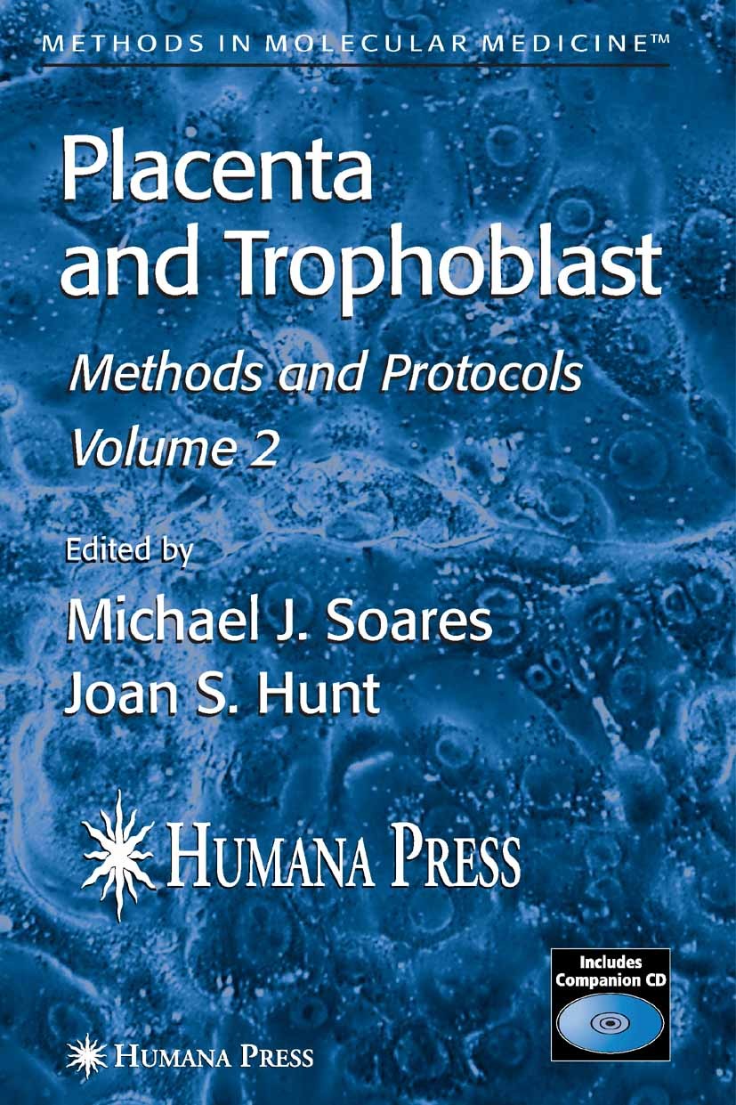 Titlebook: Placenta and Trophoblast; Methods and Protocol Michael J. Soares,Joan S. Hunt (University Disting Book 2006 Humana Press 2006 Implantat.cel Titlebook: Placenta and Trophoblast; Methods and Protocol Michael J. Soares,Joan S. Hunt (University Disting Book 2006 Humana Press 2006 Implantat.cel