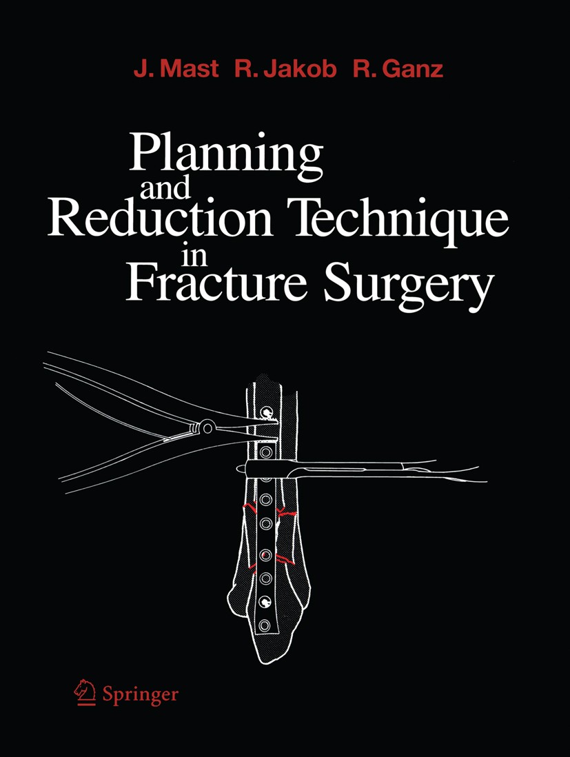 Titlebook: Planning and Reduction Technique in Fracture Surgery; Jeffrey Mast,Roland Jakob,Reinhold Ganz Book 1989 Springer-Verlag Berlin Heidelberg Titlebook: Planning and Reduction Technique in Fracture Surgery; Jeffrey Mast,Roland Jakob,Reinhold Ganz Book 1989 Springer-Verlag Berlin Heidelberg