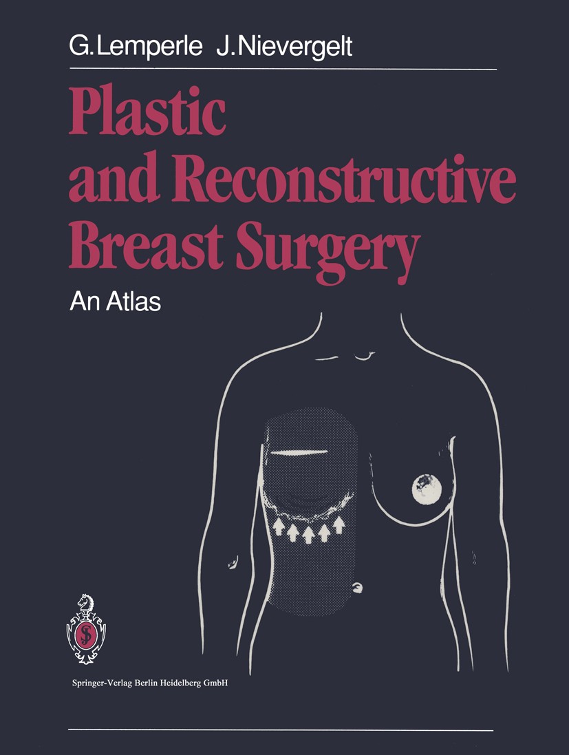 Titlebook: Plastic and Reconstructive Breast Surgery; An Atlas Gottfried Lemperle,Jürg Nievergelt Book 1991 Springer-Verlag Berlin Heidelberg 1991 Bre Titlebook: Plastic and Reconstructive Breast Surgery; An Atlas Gottfried Lemperle,Jürg Nievergelt Book 1991 Springer-Verlag Berlin Heidelberg 1991 Bre