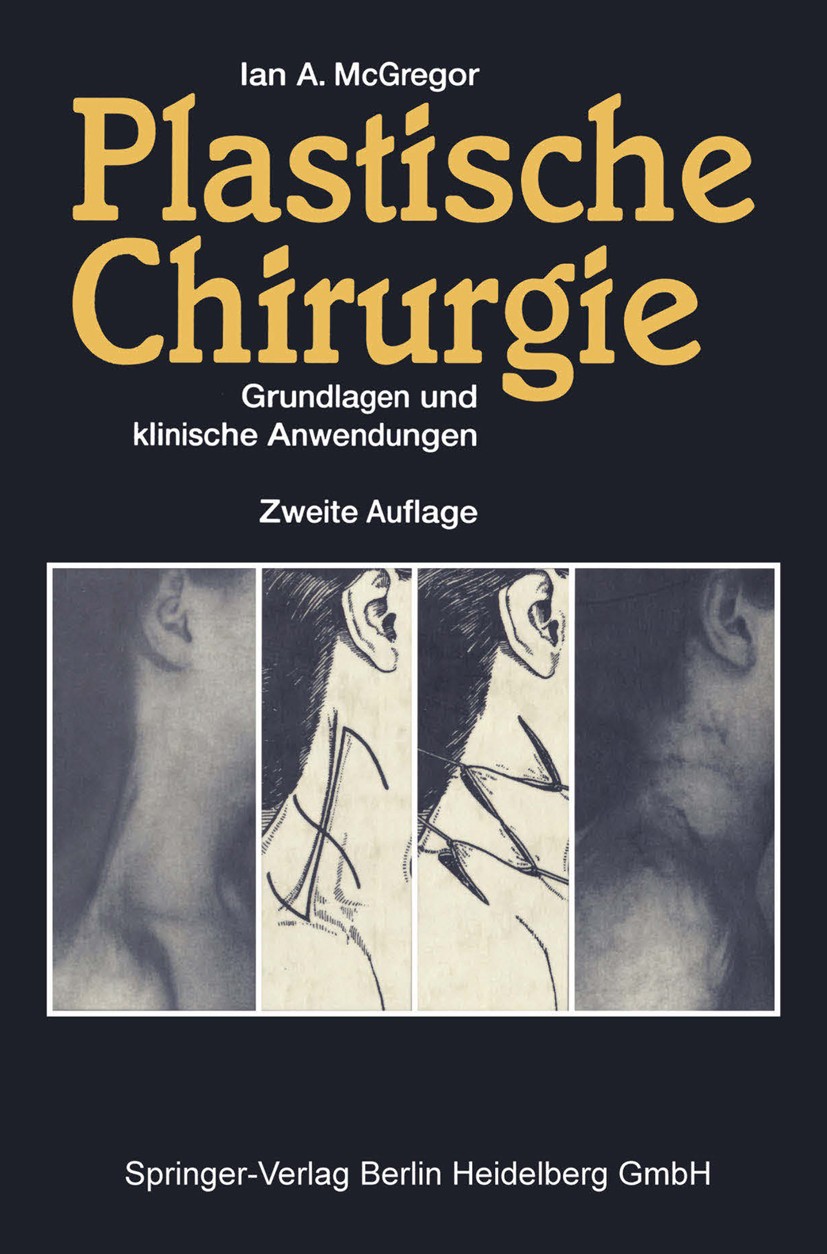 Titlebook: Plastische Chirurgie; Grundlagen und klini Ian A. McGregor Book 1992Latest edition Springer-Verlag Berlin Heidelberg 1992 Chirurgie.plastis Titlebook: Plastische Chirurgie; Grundlagen und klini Ian A. McGregor Book 1992Latest edition Springer-Verlag Berlin Heidelberg 1992 Chirurgie.plastis