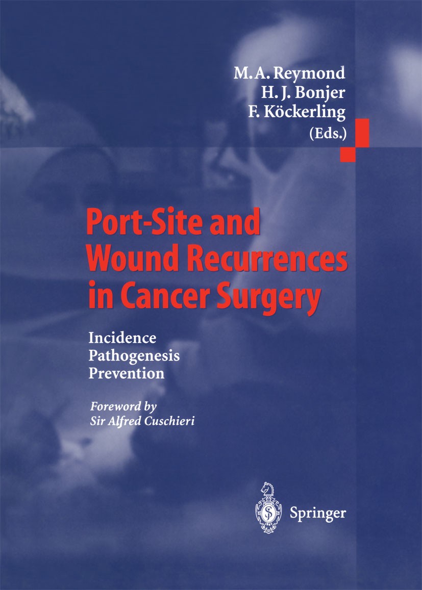 Titlebook: Port-Site and Wound Recurrences in Cancer Surgery; Incidence - Pathogen Marc A. Reymond (Associate Professor of Surgery),H Book 2000 Spring Titlebook: Port-Site and Wound Recurrences in Cancer Surgery; Incidence - Pathogen Marc A. Reymond (Associate Professor of Surgery),H Book 2000 Spring