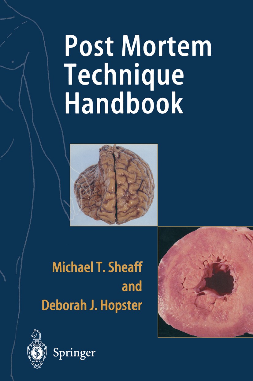 Titlebook: Post Mortem Technique Handbook; Michael T. Sheaff,Deborah J. Hopster Book 20011st edition Springer-Verlag London 2001 Post Mortem Techniqu Titlebook: Post Mortem Technique Handbook; Michael T. Sheaff,Deborah J. Hopster Book 20011st edition Springer-Verlag London 2001 Post Mortem Techniqu
