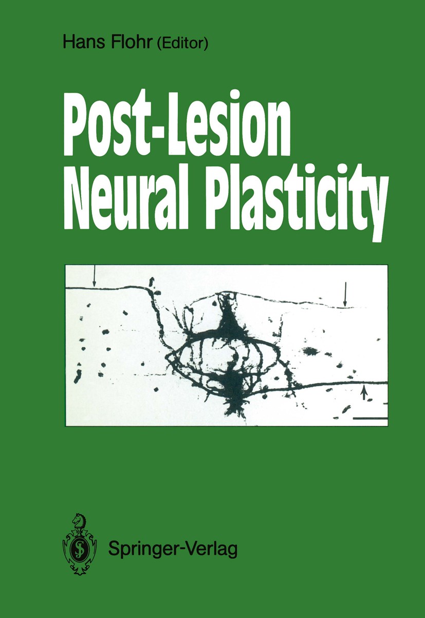 Titlebook: Post-Lesion Neural Plasticity; Hans Flohr Conference proceedings 1988 Springer-Verlag Berlin Heidelberg 1988 cortex.molecular mechanisms.n Titlebook: Post-Lesion Neural Plasticity; Hans Flohr Conference proceedings 1988 Springer-Verlag Berlin Heidelberg 1988 cortex.molecular mechanisms.n