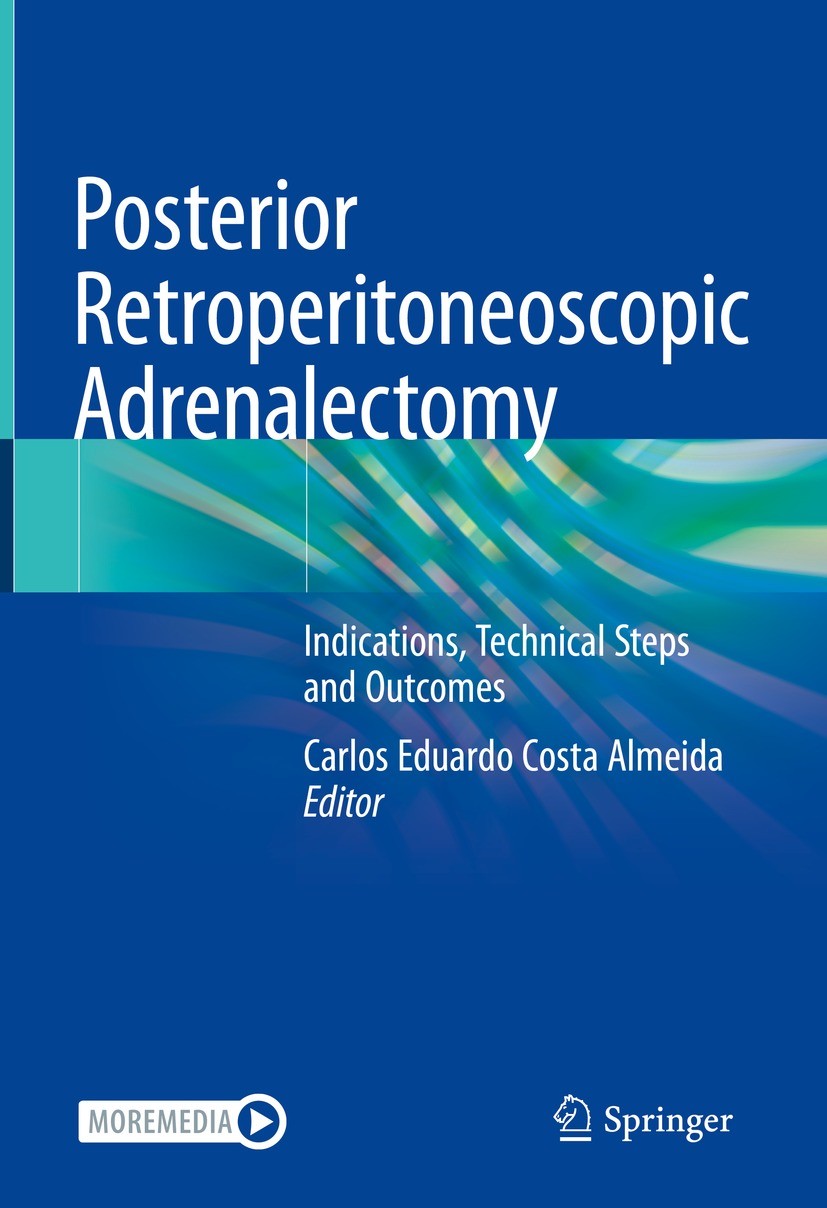 Titlebook: Posterior Retroperitoneoscopic Adrenalectomy; Indications, Technic Carlos Eduardo Costa Almeida Book 2023 The Editor(s) (if applicable) an Titlebook: Posterior Retroperitoneoscopic Adrenalectomy; Indications, Technic Carlos Eduardo Costa Almeida Book 2023 The Editor(s) (if applicable) an