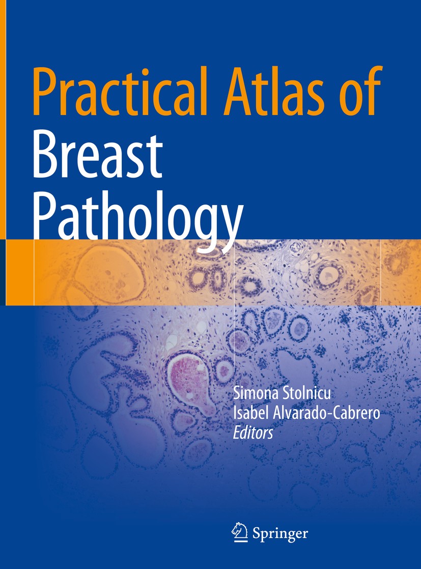 Titlebook: Practical Atlas of Breast Pathology; Simona Stolnicu,Isabel Alvarado-Cabrero Book 2018 Springer International Publishing AG, part of Sprin Titlebook: Practical Atlas of Breast Pathology; Simona Stolnicu,Isabel Alvarado-Cabrero Book 2018 Springer International Publishing AG, part of Sprin