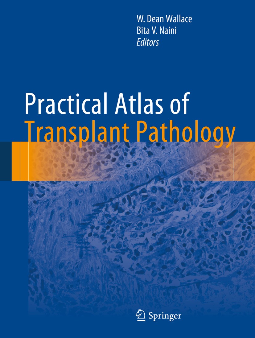 Titlebook: Practical Atlas of Transplant Pathology; W. Dean Wallace,Bita V. Naini Book 2016 Springer International Publishing Switzerland 2016 Transp Titlebook: Practical Atlas of Transplant Pathology; W. Dean Wallace,Bita V. Naini Book 2016 Springer International Publishing Switzerland 2016 Transp