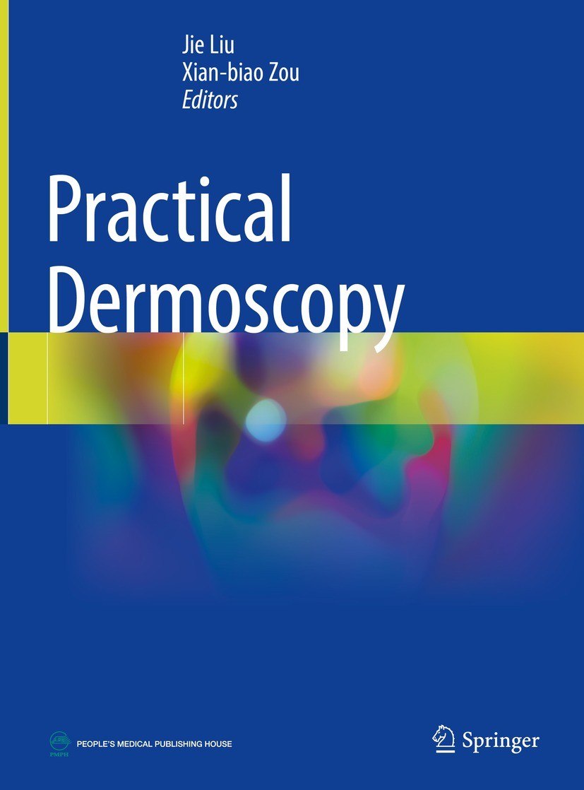 Titlebook: Practical Dermoscopy; Jie Liu,Xian-biao Zou Book 2022 People‘s Medical Publishing House, PR of China 2022 Dermoscopy.Malignant melanoma.Be Titlebook: Practical Dermoscopy; Jie Liu,Xian-biao Zou Book 2022 People‘s Medical Publishing House, PR of China 2022 Dermoscopy.Malignant melanoma.Be
