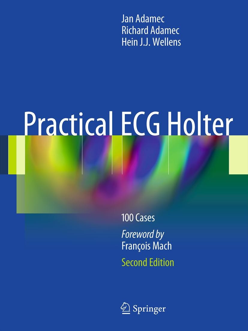 Titlebook: Practical ECG Holter; 100 Cases Jan Adamec,Richard Adamec,Hein J.J. Wellens Book 2012 Springer Science+Business Media, LLC 2012 Arrhythmia. Titlebook: Practical ECG Holter; 100 Cases Jan Adamec,Richard Adamec,Hein J.J. Wellens Book 2012 Springer Science+Business Media, LLC 2012 Arrhythmia.