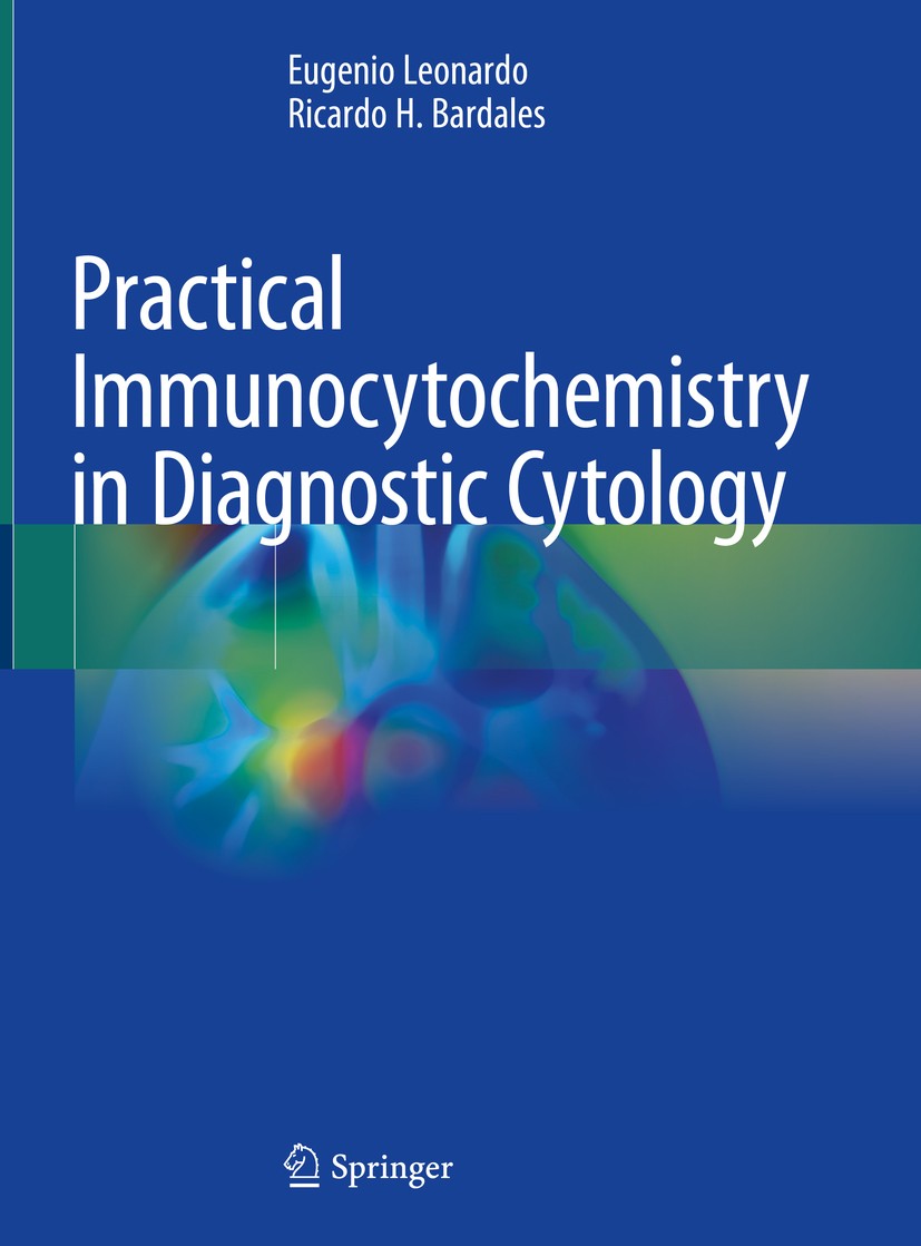 Titlebook: Practical Immunocytochemistry in Diagnostic Cytology; Eugenio Leonardo,Ricardo H. Bardales Book 2020 Springer Nature Switzerland AG 2020 c Titlebook: Practical Immunocytochemistry in Diagnostic Cytology; Eugenio Leonardo,Ricardo H. Bardales Book 2020 Springer Nature Switzerland AG 2020 c