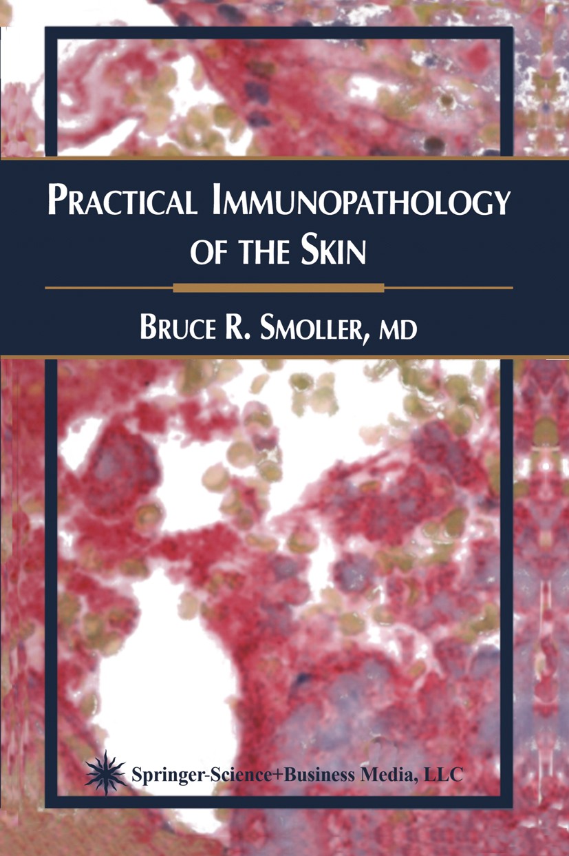 Titlebook: Practical Immunopathology of the Skin; Bruce R. Smoller Book 2002 Springer Science+Business Media New York 2002 Antigen.diseases.infectiou Titlebook: Practical Immunopathology of the Skin; Bruce R. Smoller Book 2002 Springer Science+Business Media New York 2002 Antigen.diseases.infectiou