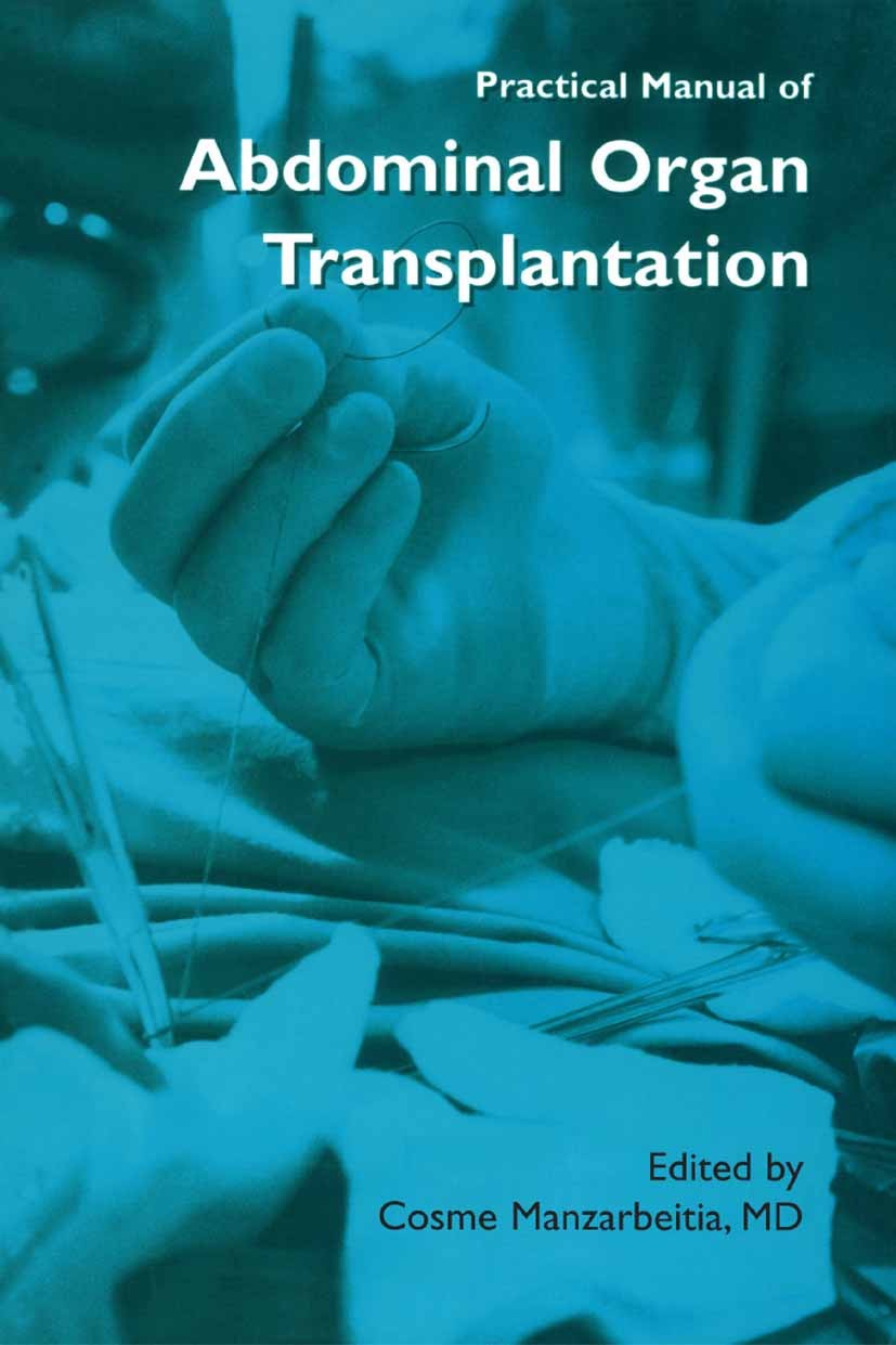 Titlebook: Practical Manual of Abdominal Organ Transplantation; Cosme Manzarbeitia Book 2002 Springer-Verlag US 2002 Immunosuppression.anesthesia.com Titlebook: Practical Manual of Abdominal Organ Transplantation; Cosme Manzarbeitia Book 2002 Springer-Verlag US 2002 Immunosuppression.anesthesia.com