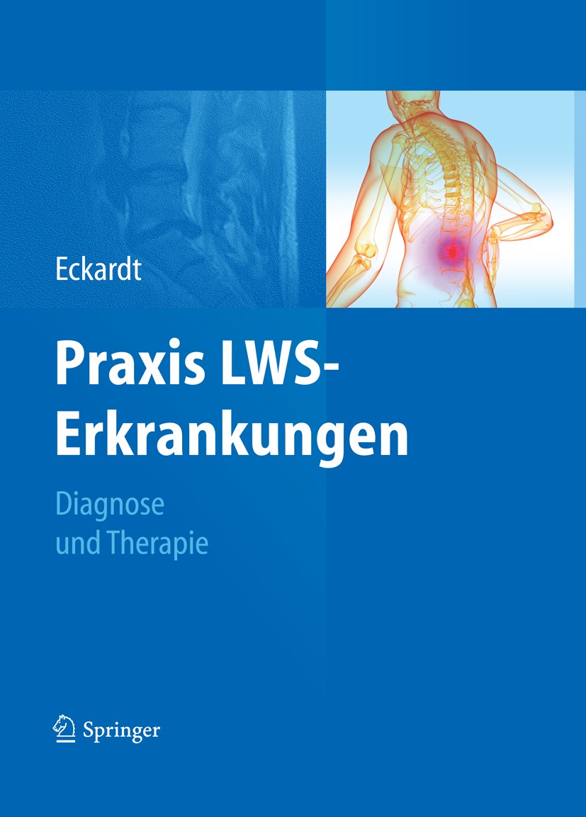 Titlebook: Praxis LWS-Erkrankungen; Diagnose und Therapi Anke Eckardt Book 2011 Springer-Verlag Berlin Heidelberg 2011 Bandscheibenvorfall.Rückenschme Titlebook: Praxis LWS-Erkrankungen; Diagnose und Therapi Anke Eckardt Book 2011 Springer-Verlag Berlin Heidelberg 2011 Bandscheibenvorfall.Rückenschme