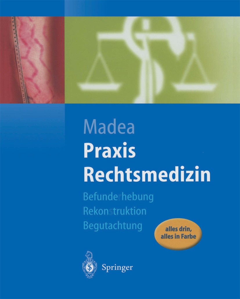 Titlebook: Praxis Rechtsmedizin; Befunderhebung, Reko Burkhard Madea Book 20031st edition Springer-Verlag Berlin Heidelberg 2003 Begutachtung.Begutach Titlebook: Praxis Rechtsmedizin; Befunderhebung, Reko Burkhard Madea Book 20031st edition Springer-Verlag Berlin Heidelberg 2003 Begutachtung.Begutach