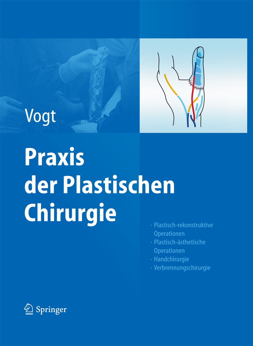 Titlebook: Praxis der Plastischen Chirurgie; Plastisch-rekonstruk Peter M. Vogt Book 2011 Springer-Verlag Berlin Heidelberg 2011 Trauma Surgery Titlebook: Praxis der Plastischen Chirurgie; Plastisch-rekonstruk Peter M. Vogt Book 2011 Springer-Verlag Berlin Heidelberg 2011 Trauma Surgery