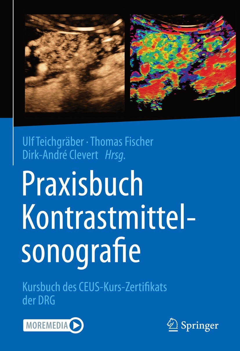 Titlebook: Praxisbuch Kontrastmittelsonografie; Kursbuch des CEUS-Ku Ulf Teichgräber,Thomas Fischer,Dirk-André Clevert Book 2022 Springer-Verlag GmbH Titlebook: Praxisbuch Kontrastmittelsonografie; Kursbuch des CEUS-Ku Ulf Teichgräber,Thomas Fischer,Dirk-André Clevert Book 2022 Springer-Verlag GmbH