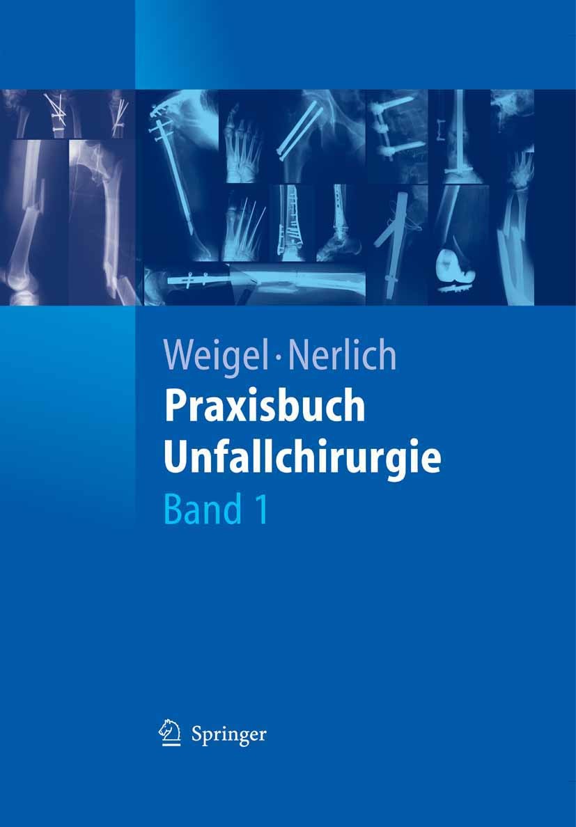 Titlebook: Praxisbuch Unfallchirurgie; Bernhard Weigel,Michael Nerlich Book 20051st edition Springer-Verlag Berlin Heidelberg 2005 Bewegungsapparat.C Titlebook: Praxisbuch Unfallchirurgie; Bernhard Weigel,Michael Nerlich Book 20051st edition Springer-Verlag Berlin Heidelberg 2005 Bewegungsapparat.C