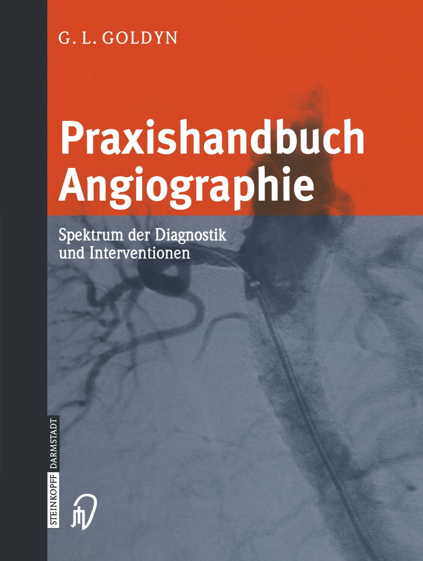 Titlebook: Praxishandbuch Angiographie; Spektrum der Diagnos Gerd L. Goldyn Book 20031st edition Springer-Verlag Berlin Heidelberg 2003 Aneurysma.Angi Titlebook: Praxishandbuch Angiographie; Spektrum der Diagnos Gerd L. Goldyn Book 20031st edition Springer-Verlag Berlin Heidelberg 2003 Aneurysma.Angi