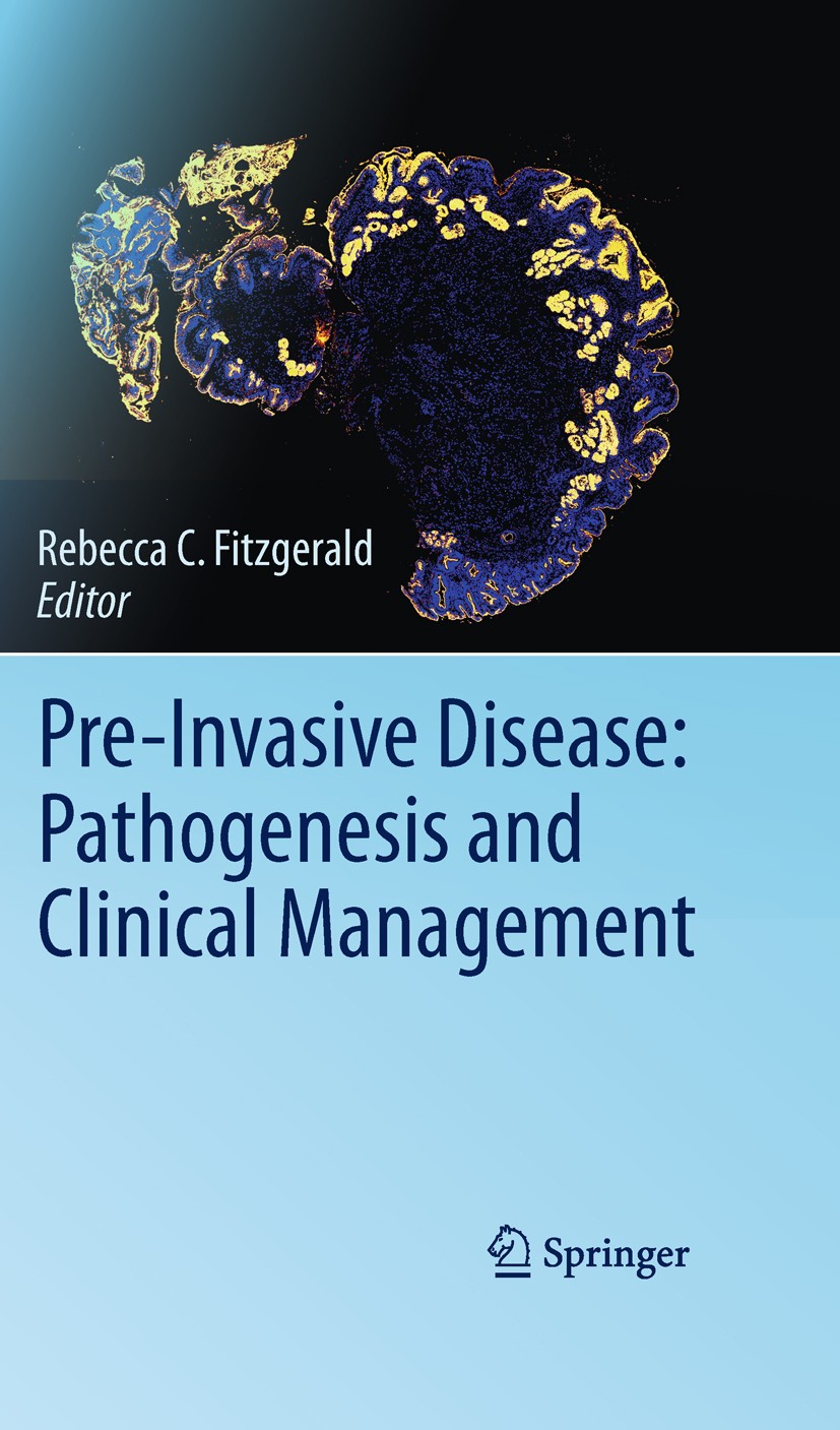 Titlebook: Pre-Invasive Disease: Pathogenesis and Clinical Management; Rebecca C. Fitzgerald Book 2011 Springer Science+Business Media, LLC 2011 Titlebook: Pre-Invasive Disease: Pathogenesis and Clinical Management; Rebecca C. Fitzgerald Book 2011 Springer Science+Business Media, LLC 2011