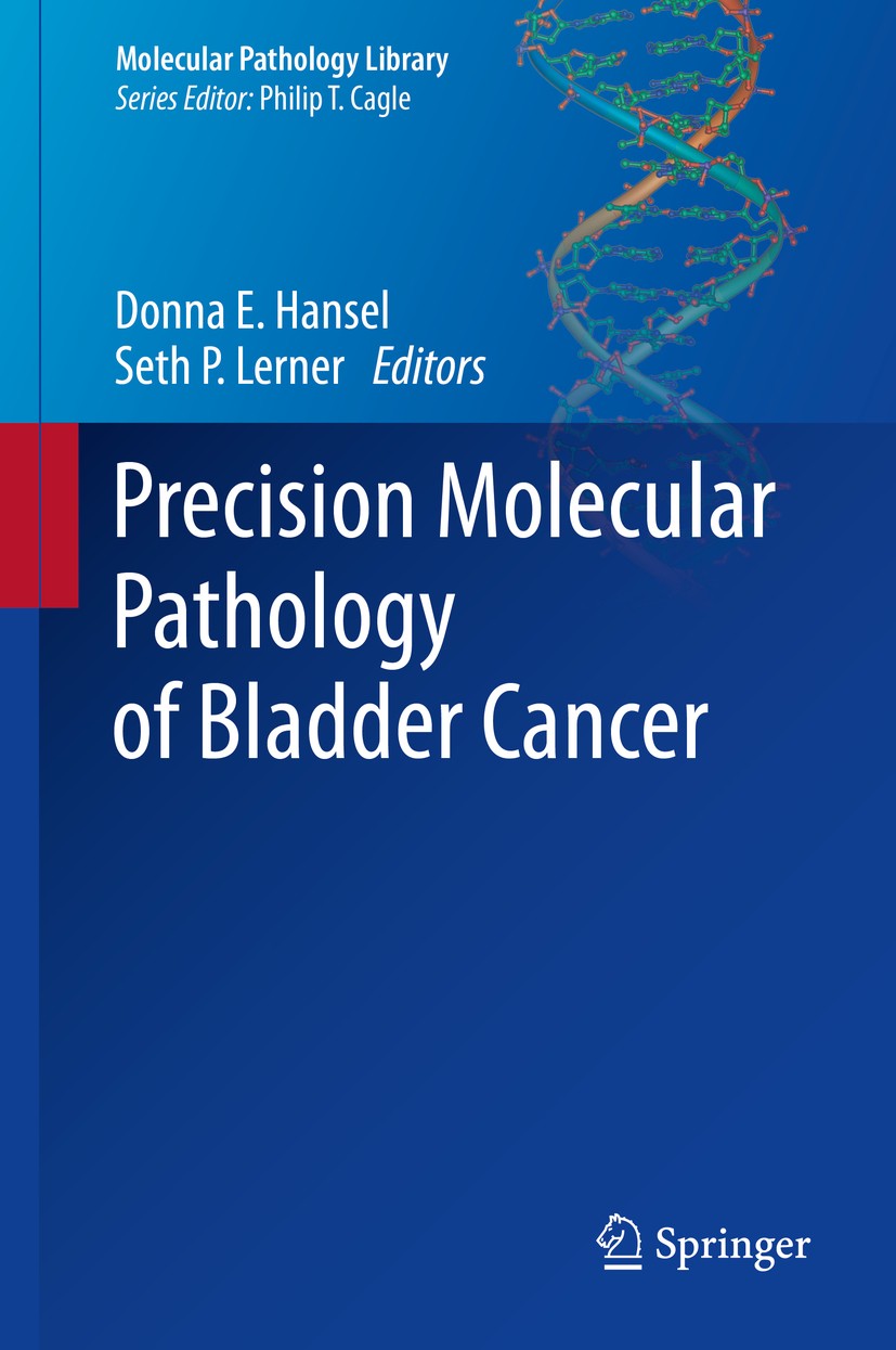 Titlebook: Precision Molecular Pathology of Bladder Cancer; Donna E. Hansel,Seth P. Lerner Book 2018 Springer International Publishing AG 2018 Adenoc Titlebook: Precision Molecular Pathology of Bladder Cancer; Donna E. Hansel,Seth P. Lerner Book 2018 Springer International Publishing AG 2018 Adenoc