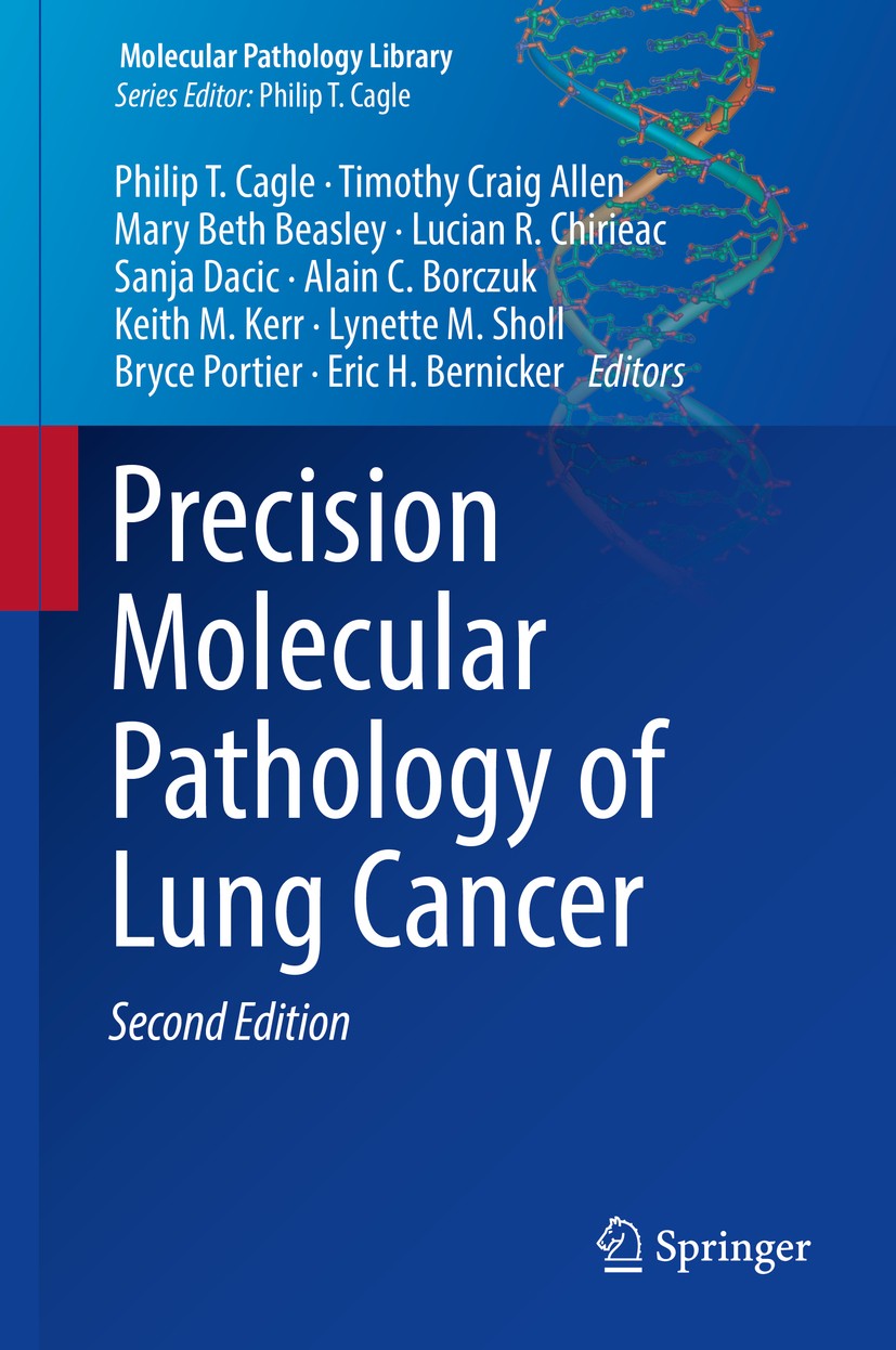 Titlebook: Precision Molecular Pathology of Lung Cancer; Philip T. Cagle,Timothy Craig Allen,Eric H. Bernic Book 2018Latest edition Springer Internat Titlebook: Precision Molecular Pathology of Lung Cancer; Philip T. Cagle,Timothy Craig Allen,Eric H. Bernic Book 2018Latest edition Springer Internat