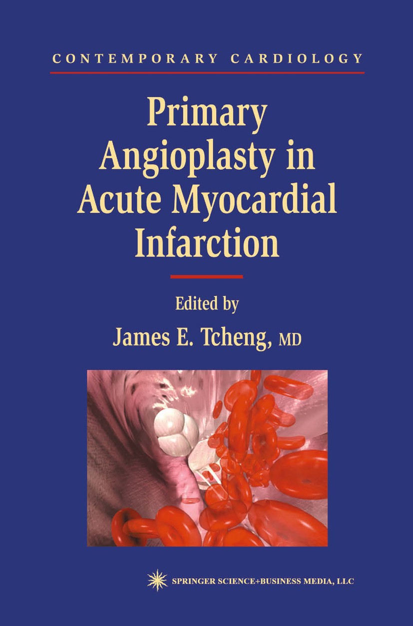 Titlebook: Primary Angioplasty in Acute Myocardial Infarction; James E. Tcheng Book 20021st edition Humana Press 2002 Acute Myocardial Infarction.Cel Titlebook: Primary Angioplasty in Acute Myocardial Infarction; James E. Tcheng Book 20021st edition Humana Press 2002 Acute Myocardial Infarction.Cel
