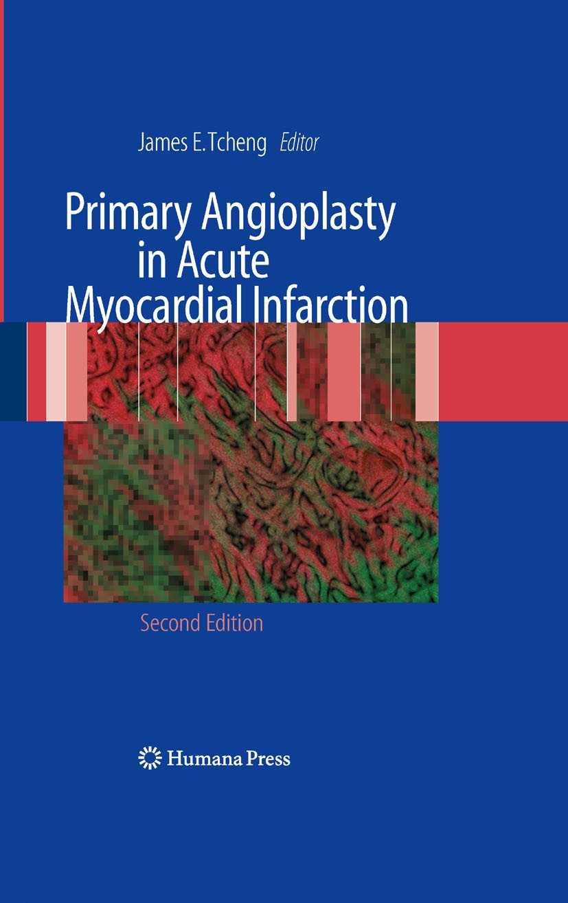 Titlebook: Primary Angioplasty in Acute Myocardial Infarction; James E. Tcheng Book 2009Latest edition Humana Press 2009 Acute Myocardial Infarction. Titlebook: Primary Angioplasty in Acute Myocardial Infarction; James E. Tcheng Book 2009Latest edition Humana Press 2009 Acute Myocardial Infarction.