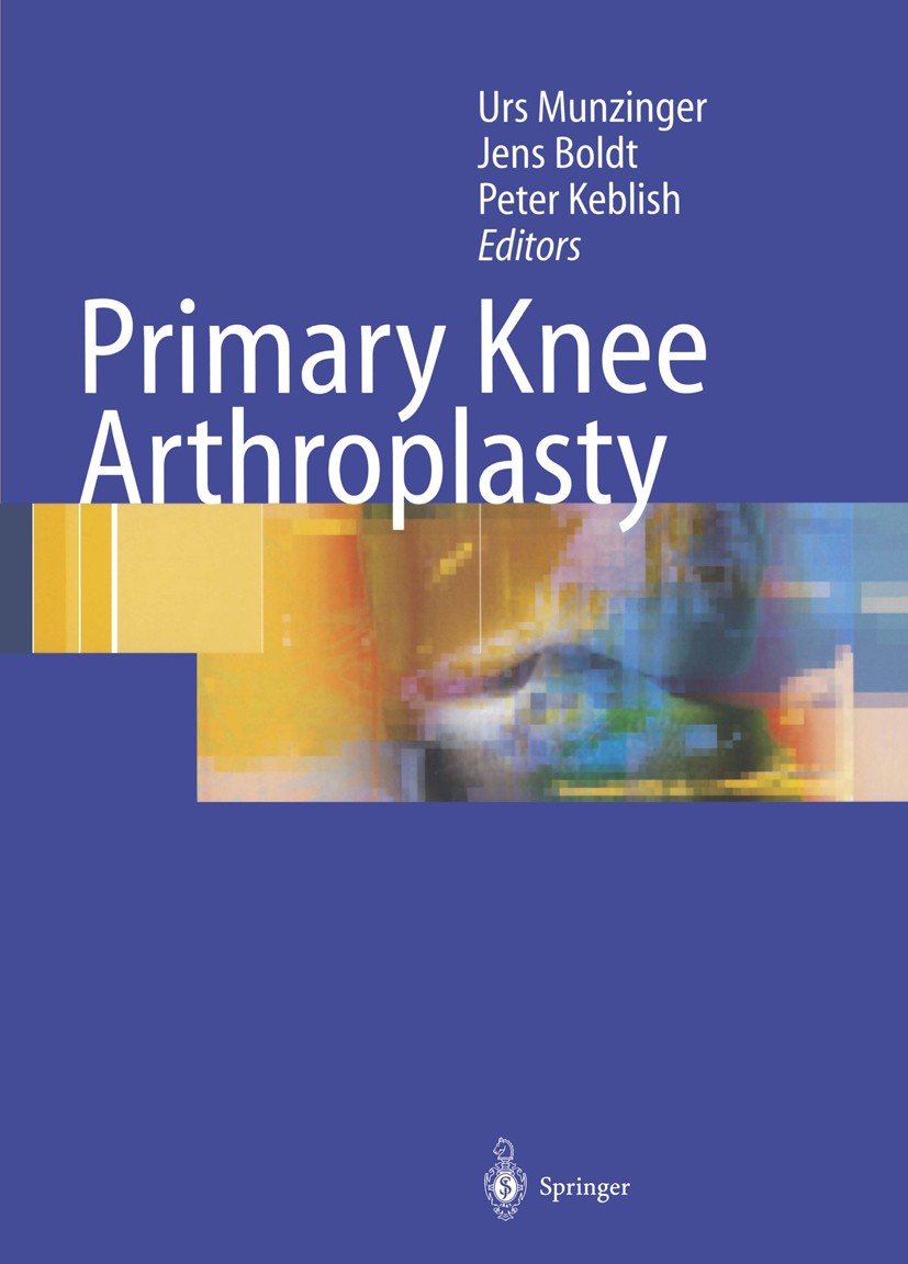 Titlebook: Primary Knee Arthroplasty; Urs K. Munzinger (Senior Consultant Orthopaedic Su Book 2004 Springer-Verlag Berlin Heidelberg 2004 Basic Scien Titlebook: Primary Knee Arthroplasty; Urs K. Munzinger (Senior Consultant Orthopaedic Su Book 2004 Springer-Verlag Berlin Heidelberg 2004 Basic Scien