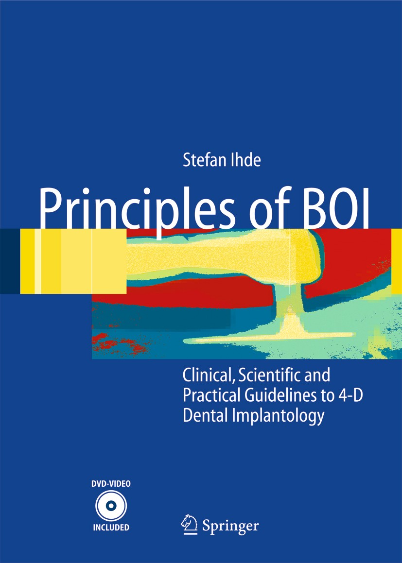 Titlebook: Principles of BOI; Clinical, Scientific Stefan Ihde Book 2005 Springer-Verlag Berlin Heidelberg 2005 Basal osseointegration procedure.Corti Titlebook: Principles of BOI; Clinical, Scientific Stefan Ihde Book 2005 Springer-Verlag Berlin Heidelberg 2005 Basal osseointegration procedure.Corti