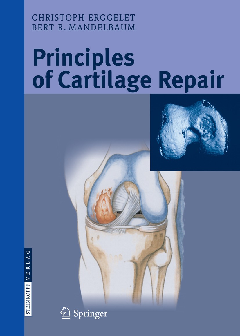 Titlebook: Principles of Cartilage Repair; Christoph Erggelet,Bert R. Mandelbaum,Jason M. Sco Book 2008 Steinkopff-Verlag Darmstadt 2008 Cartilage Re Titlebook: Principles of Cartilage Repair; Christoph Erggelet,Bert R. Mandelbaum,Jason M. Sco Book 2008 Steinkopff-Verlag Darmstadt 2008 Cartilage Re