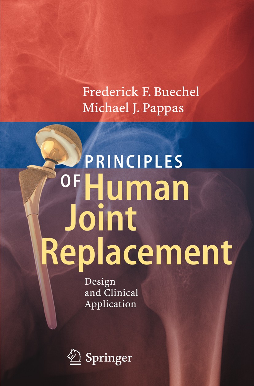 Titlebook: Principles of Human Joint Replacement; Design and Clinical Frederick F. Buechel,Michael J. Pappas Book 20121st edition Springer Berlin Hei Titlebook: Principles of Human Joint Replacement; Design and Clinical Frederick F. Buechel,Michael J. Pappas Book 20121st edition Springer Berlin Hei