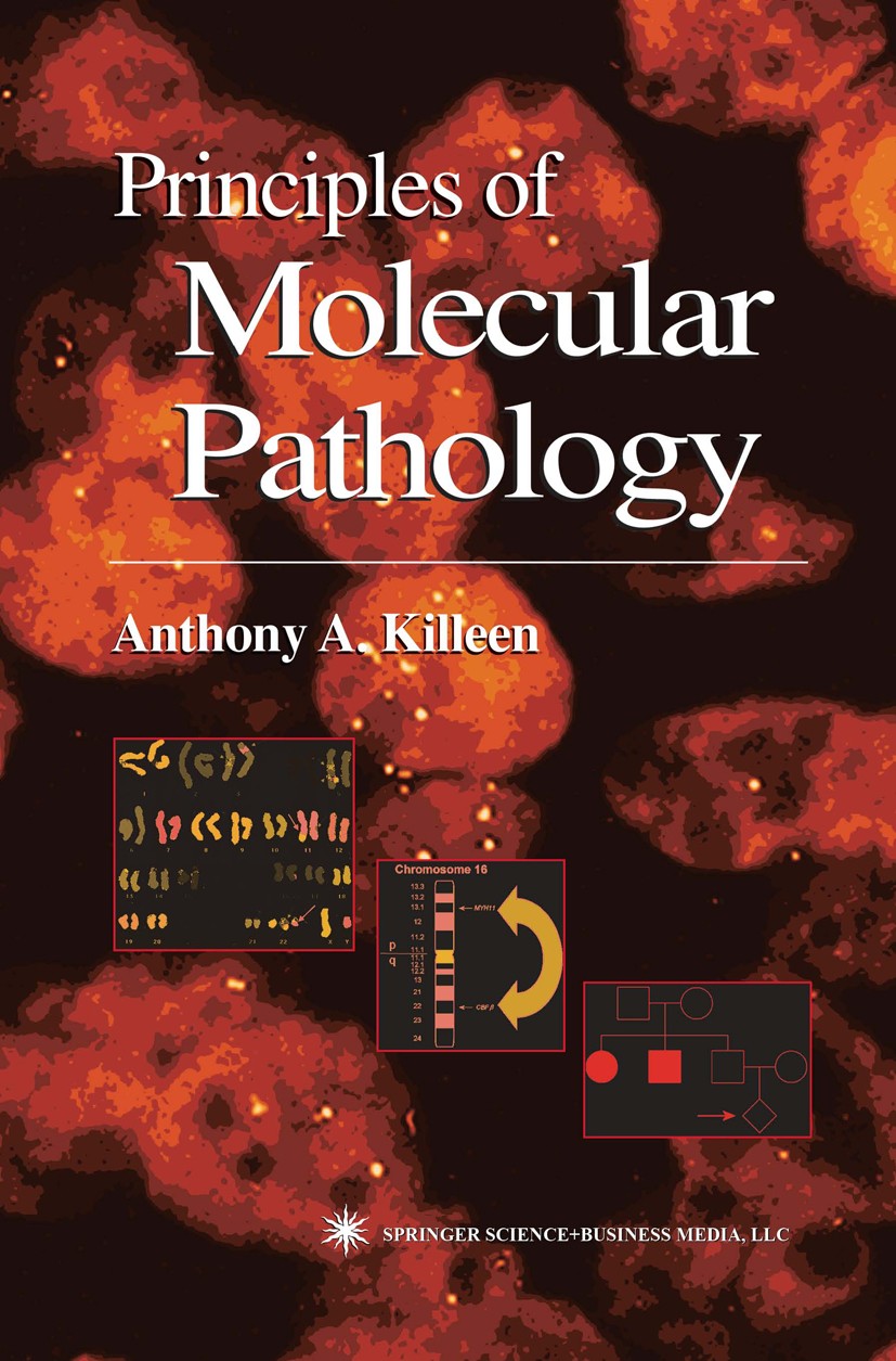 Titlebook: Principles of Molecular Pathology; Anthony A. Killeen Book 2004 Springer Science+Business Media New York 2004 Molecular Diagnostics.cancer Titlebook: Principles of Molecular Pathology; Anthony A. Killeen Book 2004 Springer Science+Business Media New York 2004 Molecular Diagnostics.cancer