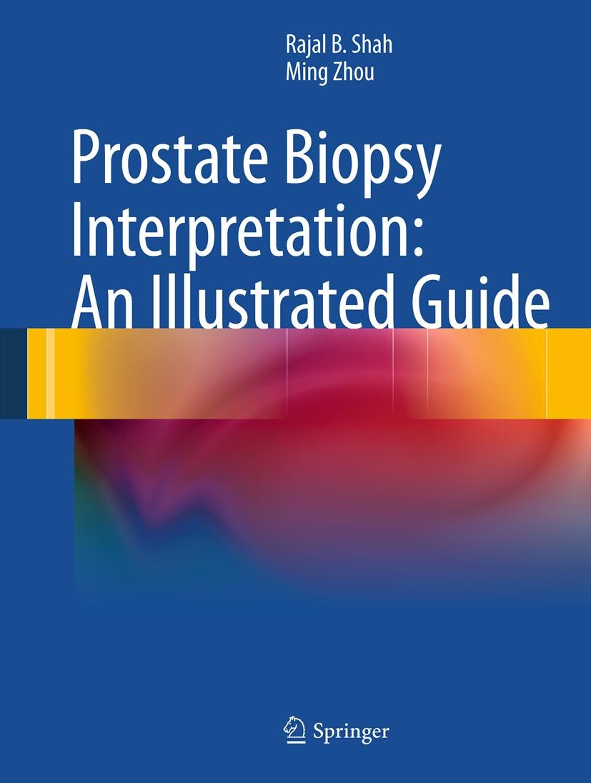 Titlebook: Prostate Biopsy Interpretation: An Illustrated Guide; Rajal B. Shah,Ming Zhou Book 20121st edition Springer-Verlag Berlin Heidelberg 2012 Titlebook: Prostate Biopsy Interpretation: An Illustrated Guide; Rajal B. Shah,Ming Zhou Book 20121st edition Springer-Verlag Berlin Heidelberg 2012