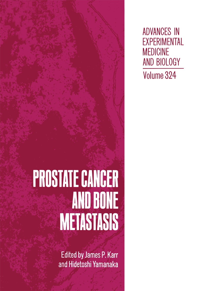 Titlebook: Prostate Cancer and Bone Metastasis; James P. Karr,Hidetoshi Yamanaka Book 1992 The Editor(s) (if applicable) and The Author(s), under exc Titlebook: Prostate Cancer and Bone Metastasis; James P. Karr,Hidetoshi Yamanaka Book 1992 The Editor(s) (if applicable) and The Author(s), under exc