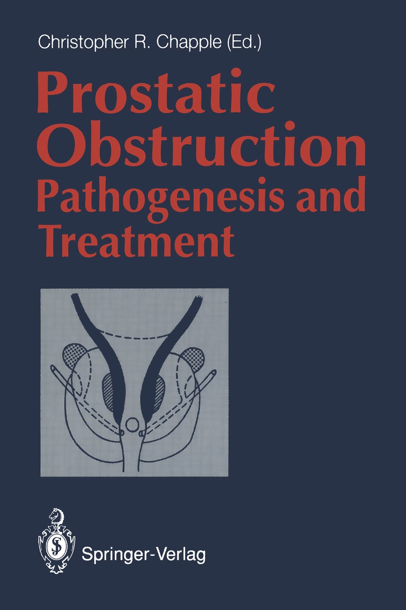 Titlebook: Prostatic Obstruction; Pathogenesis and Tre Christopher R. Chapple Book 1994 Springer-Verlag London Limited 1994 Benign Prostatic Hyperplas Titlebook: Prostatic Obstruction; Pathogenesis and Tre Christopher R. Chapple Book 1994 Springer-Verlag London Limited 1994 Benign Prostatic Hyperplas